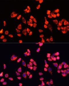 Immunofluorescence analysis of HeLa cells using Anti-Angiopoietin 2 / ANG2 Antibody (A12691) at a dilution of 1:100 (40x lens). DAPI was used to stain the cell nuclei (blue).