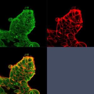 Antibody anti-EIF4E pcrp-EIF4E-1D3 100 µg