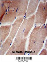 Anti-RPL5 Rabbit Polyclonal Antibody (FITC (Fluorescein Isothiocyanate))