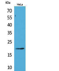 Western blot analysis of extracts from HeLa cells using Anti-CD3D Antibody