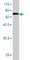 Anti-ENO1 Mouse Monoclonal Antibody [clone: 8G8]