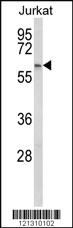 Anti-PCCB Rabbit Polyclonal Antibody [clone: 399CT9.3.4]