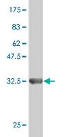 Anti-ZNF85 Mouse Monoclonal Antibody [clone: 4D12]