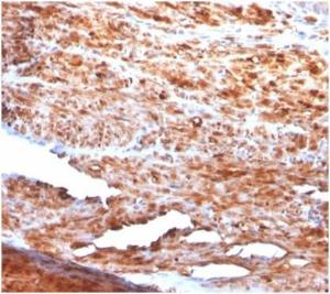 Immunohistochemical analysis of formalin-fixed, paraffin-embedded human uterus using Anti-Desmin Antibody [rDES/1711] at 2 µg/ml in PBS for 30 minutes at room temperature