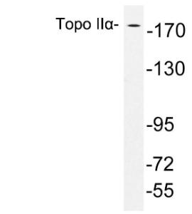 Western blot analysis of lysates from Jurkat cells using Anti-Topo IIalpha Antibody