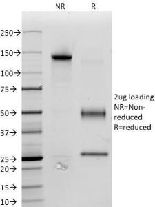 SDS-PAGE analysis of Anti-CD34 Antibody [ICO-115] under non-reduced and reduced conditions; showing intact IgG and intact heavy and light chains, respectively. SDS-PAGE analysis confirms the integrity and purity of the antibody