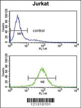 Anti-PCCB Rabbit Polyclonal Antibody [clone: 399CT9.3.4]