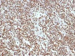 Immunohistochemical analysis of formalin-fixed, paraffin-embedded human lymph node tissue using Anti-Ku80 Antibody [XRCC5/7315]