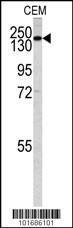 Anti-PI3KC2G Rabbit Polyclonal Antibody (FITC (Fluorescein))