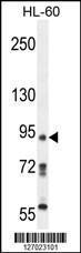 Anti-KRI1 Rabbit Polyclonal Antibody (AP (Alkaline Phosphatase))