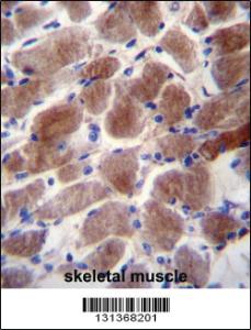 Anti-BCLAF1 Rabbit Polyclonal Antibody