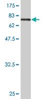 Anti-ENO1 Mouse Monoclonal Antibody [clone: 3C8]