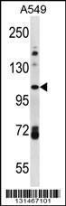 Anti-FA13B Rabbit Polyclonal Antibody (Biotin)