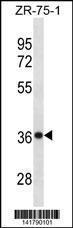 Anti-CHORDC1 Rabbit Polyclonal Antibody (HRP (Horseradish Peroxidase))