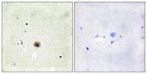 Immunohistochemical analysis of paraffin-embedded human brain tissue using Anti-CRP1 Antibody. The right hand panel represents a negative control, where the antibody was pre-incubated with the immunising peptide