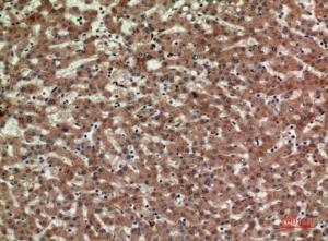 Immunohistochemical analysis of paraffin-embedded human liver using Anti-CD3D Antibody