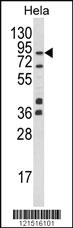 Anti-UHRF1 Rabbit Polyclonal Antibody