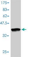 Anti-RAD51C Mouse Monoclonal Antibody [clone: 3F3-5C6]