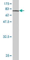 Anti-ENO1 Mouse Monoclonal Antibody [clone: 1G1]