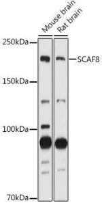 Western blot analysis of extracts of various cell lines, using Anti-SCAF8 Antibody (A308276) at 1:1000 dilution. The secondary Antibody was Goat Anti-Rabbit IgG H&L Antibody (HRP) at 1:10000 dilution. Lysates/proteins were present at 25 µg per lane