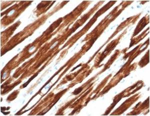 Immunohistochemical analysis of formalin-fixed, paraffin-embedded human uterus tissue using Anti-Desmin Antibody [rDES/1711]