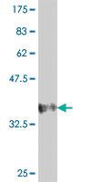 Anti-MGAT4B Mouse Polyclonal Antibody