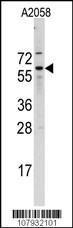 Anti-CDC25B Rabbit Polyclonal Antibody (AP (Alkaline Phosphatase))