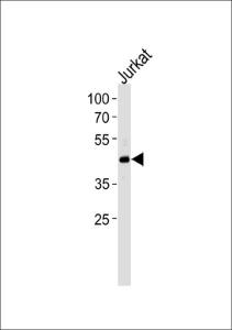 Anti-FOXO4 Rabbit Polyclonal Antibody (AP (Alkaline Phosphatase))