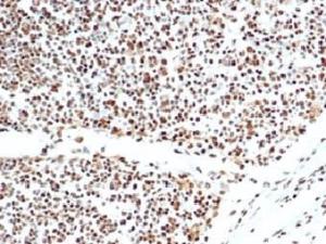 Immunohistochemical analysis of formalin-fixed, paraffin-embedded human lymph node tissue using Anti-Ku80 Antibody [XRCC5/7317]