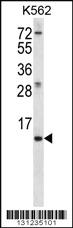 Anti-MEIG1 Rabbit Polyclonal Antibody