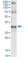 Anti-HUS1 Polyclonal Antibody Pair