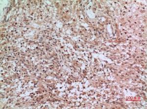 Immunohistochemical analysis of paraffin-embedded human brain using Anti-CD3D Antibody