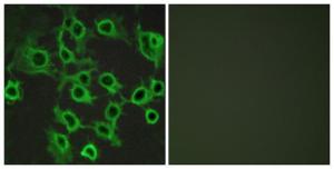 Antibody anti-CCRL2 A99833-100 100 µg