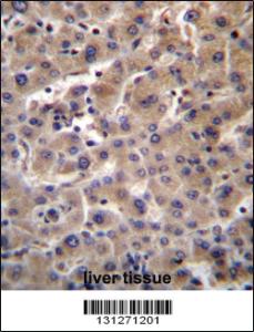 Anti-CP013 Rabbit Polyclonal Antibody