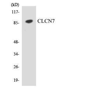 Western blot analysis of the lysates from COLO205 cells using Anti-CLCN7 Antibody