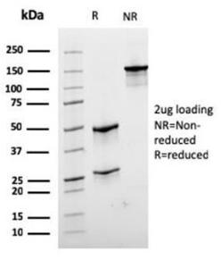 SDS-PAGE analysis of Anti-Desmin Antibody [rDES/1711] under non-reduced and reduced conditions; showing intact IgG and intact heavy and light chains, respectively. SDS-PAGE analysis confirms the integrity and purity of the antibody