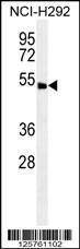 Anti-ABHD8 Rabbit Polyclonal Antibody (Biotin)