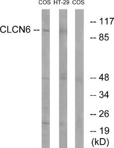 Western blot analysis of lysates from COS7 and HT-29 cells using Anti-CLCN6 Antibody. The right hand lane represents a negative control, where the antibody is blocked by the immunising peptide.