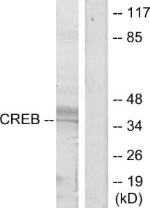 Western blot analysis of lysates from HeLa cells, treated with UV using Anti-CREB Antibody. The right hand lane represents a negative control, where the antibody is blocked by the immunising peptide