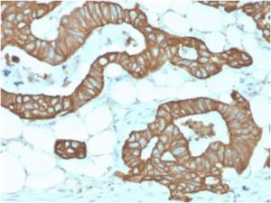 Immunohistochemical analysis of formalin-fixed, paraffin-embedded human colon using Anti-Cytokeratin 19 Antibody [KRT19/1959R]