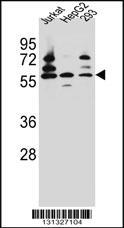 Anti-PDP1 Rabbit Polyclonal Antibody