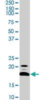 Anti-STMN1 Rabbit Polyclonal Antibody