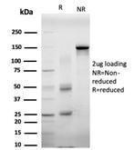 Antibody anti-EIF4E pcrp-EIF4E-1D3 100 µg