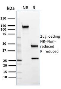 SDS-PAGE analysis of Anti-SREBP2 Antibody [SREBP2/1579] under non-reduced and reduced conditions; showing intact IgG and intact heavy and light chains, respectively. SDS-PAGE analysis confirms the integrity and purity of the Antibody