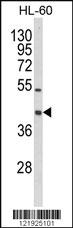 Anti-PRPF4B Rabbit Polyclonal Antibody