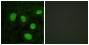 Immunofluorescence analysis of HeLa cells using Anti-Histone H1oo Antibody. The right hand panel represents a negative control, where the antibody was pre-incubated with the immunising peptide.