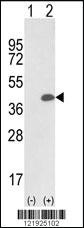 Anti-PRPF4B Rabbit Polyclonal Antibody