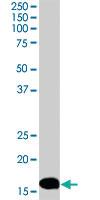 Anti-STMN1 Rabbit Polyclonal Antibody