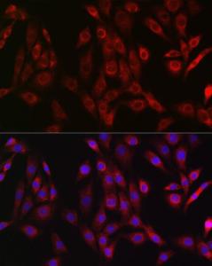 Immunofluorescence analysis of NIH/3T3 cells using Anti-OTULIN Antibody (A305722) at a dilution of 1:50 (40x lens). DAPI was used to stain the cell nuclei (blue).