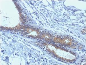 Antibody anti-BRCA1 BRCA11398 100 µg